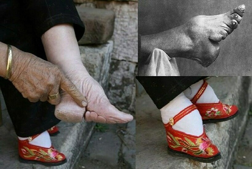 ноги в Китае